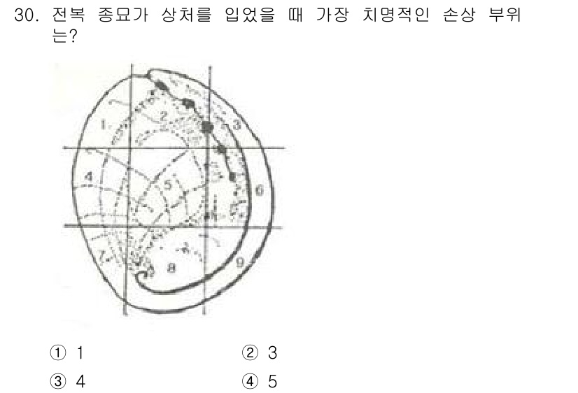 수산양식기사 2018년 30번 - 전복의 상처부위는 주로 외부의 물리적 손상으로 인해 발생하며, 치료가 필... 에 관한 핵심 기출문제