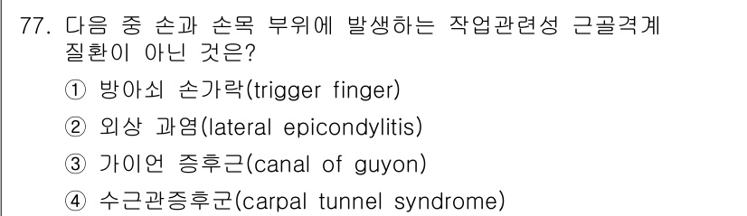 인간공학기사 2015년 77번 - 정답은 4번 수근관증후군(carpal tunnel syndrome)입니다... 에 관한 핵심 기출문제