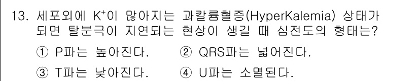 의공기사 2020년 13번 - 고칼륨혈증(Hyperkalemia) 상태에서는 심전도 변화가 발생하며, ... 에 관한 핵심 기출문제
