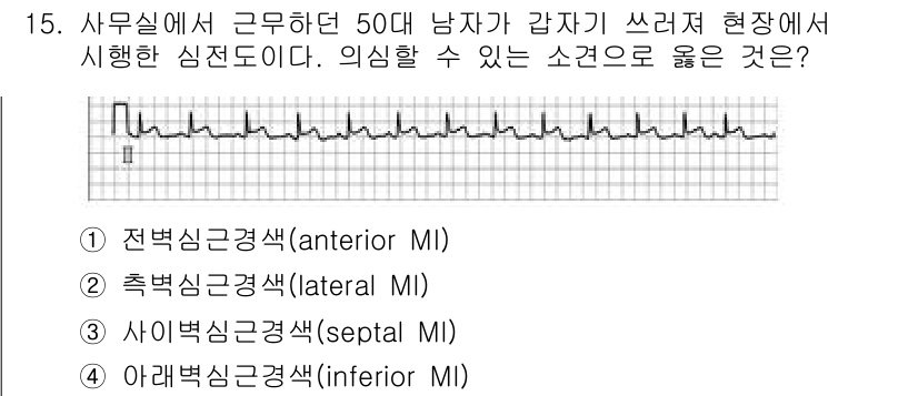 소방공무원(경력)_응급처치학개론 2023년 15번 - 정답은 4번, 아래벽신근경색(inferior MI)입니다. 심전도 결과에... 에 관한 핵심 기출문제