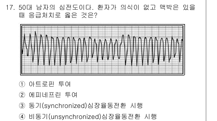 소방공무원(경력)_응급처치학개론 2024년 17번 - 환자가 의식이 없고 맥박이 없는 경우, 즉 생명이 위급한 상황에서는 즉각... 에 관한 핵심 기출문제